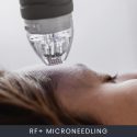 Online RF+ Microneedling Course