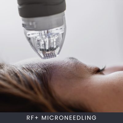 Online RF+ Microneedling Course