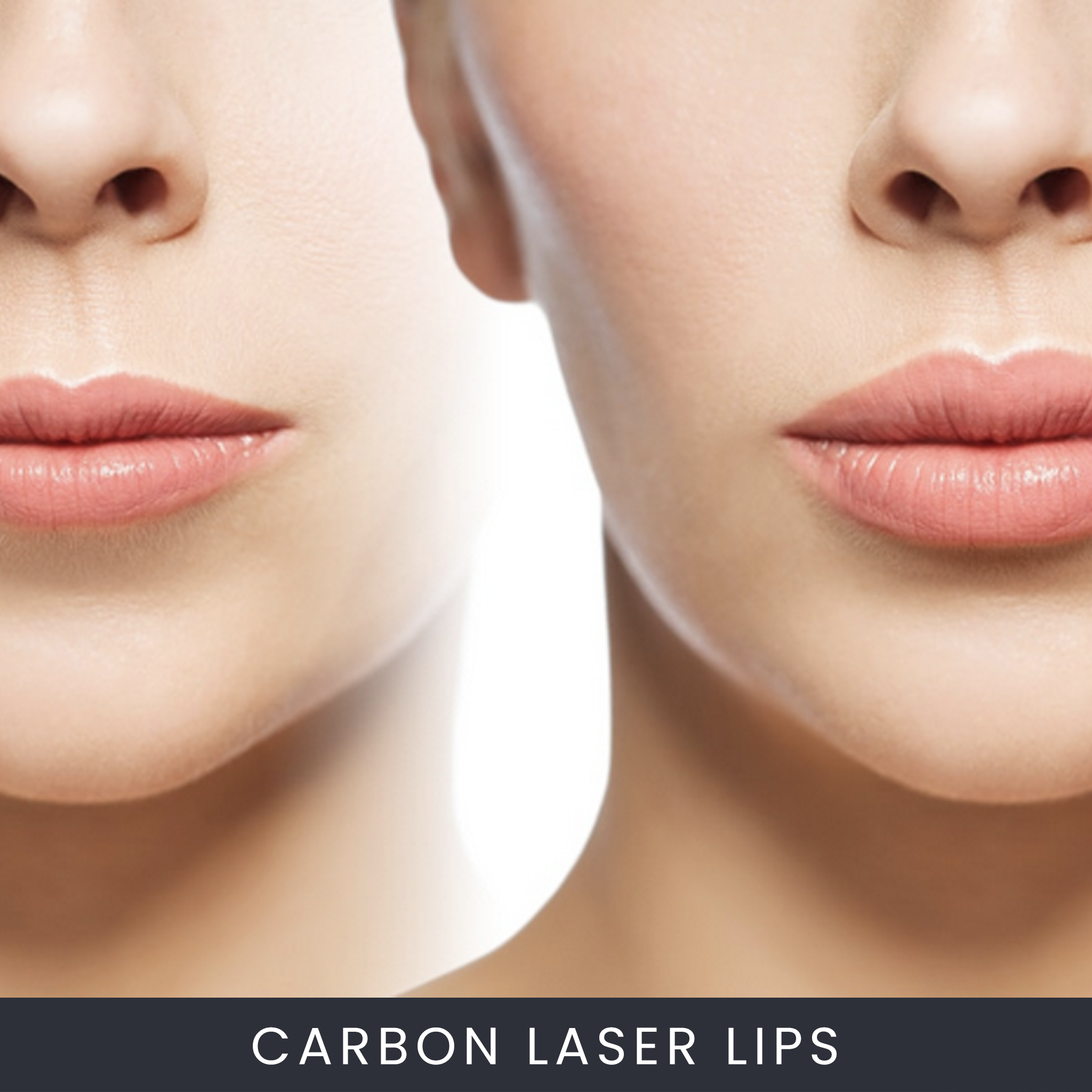 Online Carbon Laser Lip Plumping Course The Online Beauty Courses