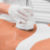 ultrasound cavitation