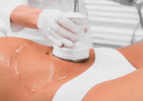 ultrasound cavitation