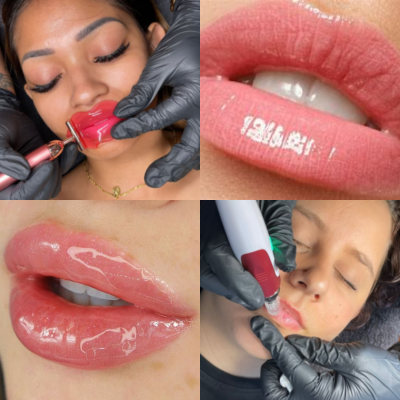 Hydra Gloss Lips