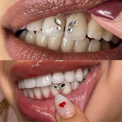 Tooth Gem Course